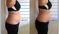 Medical Weight Loss Programs Springfield TN Before and After Side Profile Medical Weight Loss Programs Springfield TN Before and After Side Profile